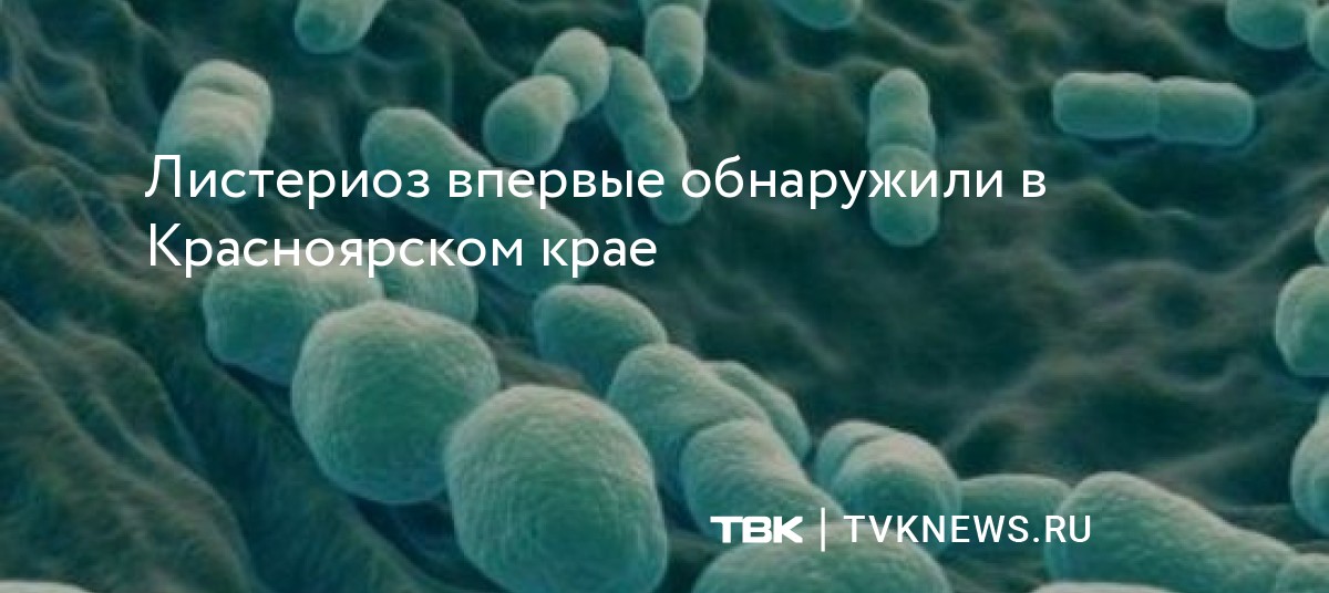 Листериоз впервые обнаружили в Красноярском крае