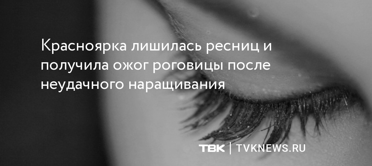 Красноярка лишилась ресниц и получила ожог роговицы после неудачного ...