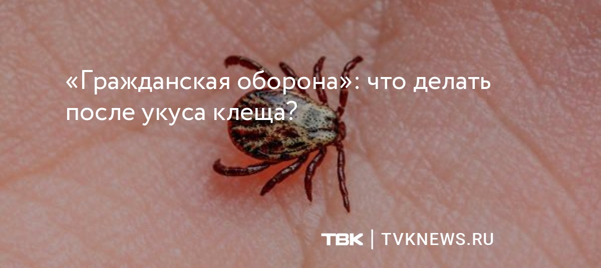 «Гражданская оборона»: что делать после укуса клеща?