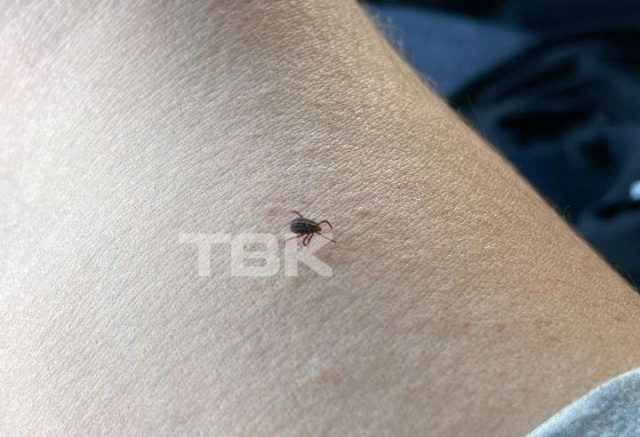 5 случаев присасывания клещей зарегистрировали в Красноярском крае с начала сезона