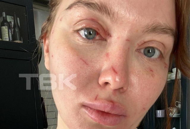 «Повалила на пол и пыталась выдавить глаз»: красноярская блогер заявила о нападении консьержа в подъезде