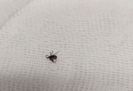 Первый случай присасывания клеща в сезоне зафиксировали в Красноярске