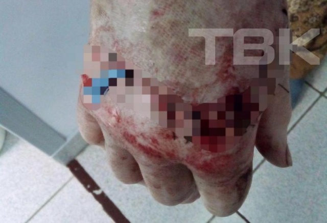 Красноярец избил Ветерана труда и ее внучку из-за того, что их пес лаял на его собаку во время прогулки Красноярец избил Ветерана труда и ее внучку из-за того, что их пес лаял на его собаку во время прогулки