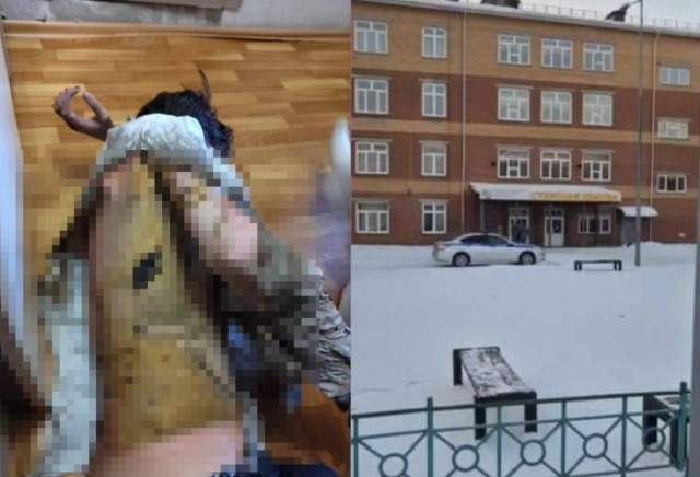 Мальчик, пострадавший от ожогов в красноярской школе, самостоятельно добирался до дома 