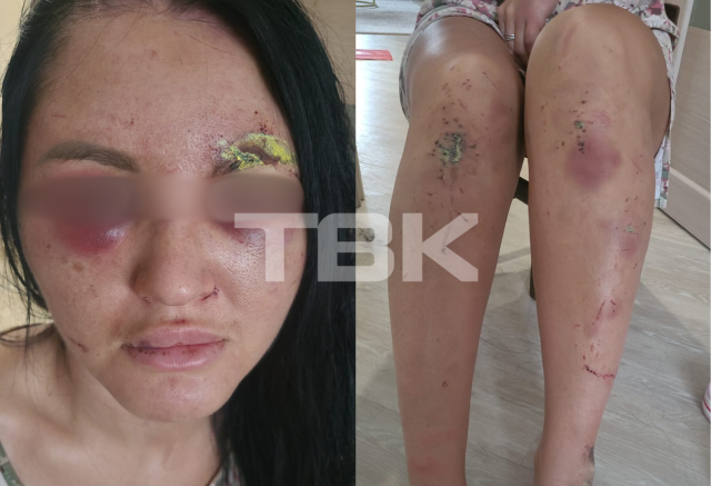 «Два часа бил меня палками»: мужчина избил сожительницу на почве ревности в Красноярском крае 