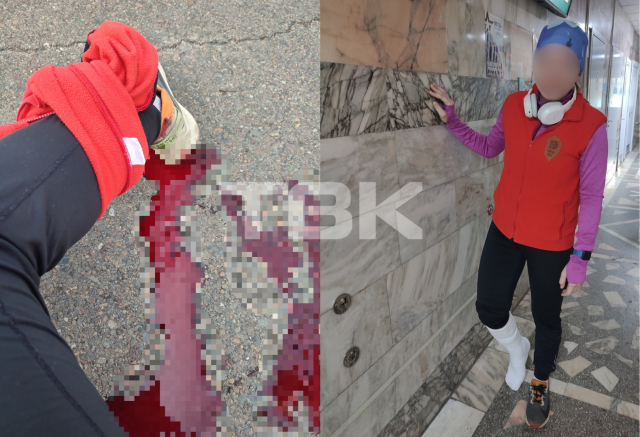 «Скрылся с места, оставив меня в луже крови»: самокатчик сбил красноярку на набережной