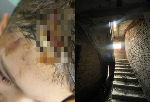 «В пяти сантиметрах от смерти»: 12-летний мальчик упал в шахту лифта недостроя в Красноярске