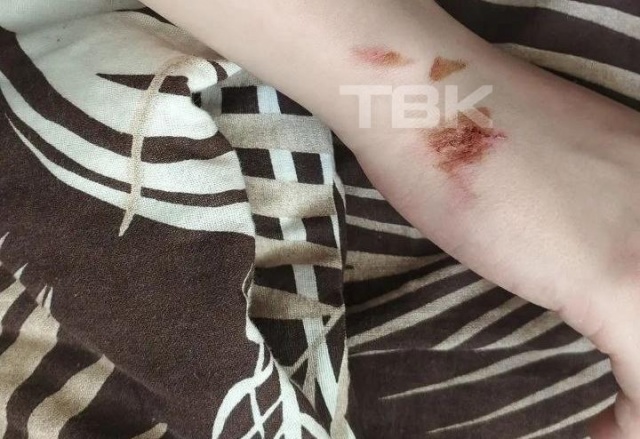 «Тошнота, болит голова и всё тело»: мама подростка из Ачинска рассказала о состоянии сына после избиения