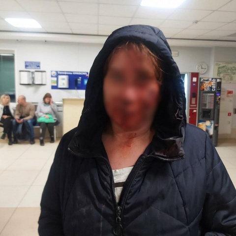 Красноярку избили монтировкой из-за сообщения в чате дачников