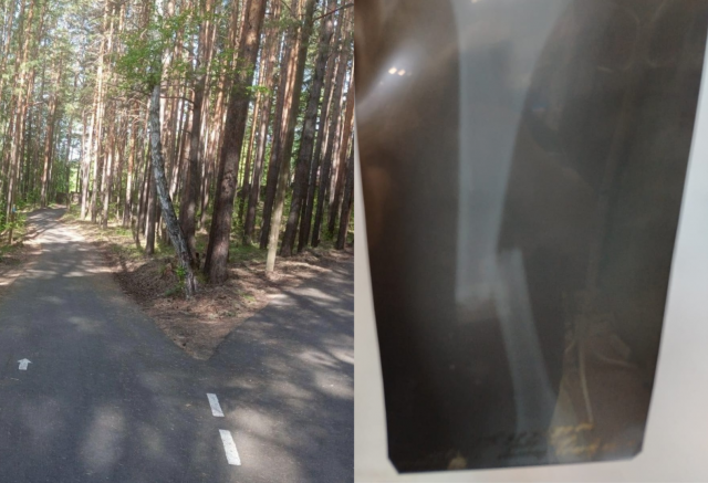 «Ногу по кусочкам собирали»: подросток на питбайке вылетел на лыжную трассу и столкнулся с 12-летним мальчиком 