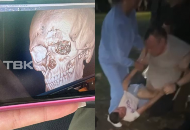 Экс-футболиста красноярского «Енисея» не будут судить за драку на базе отдыха