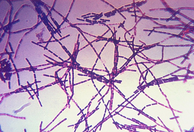 Случаи заражения сибирской язвой выявляют в России: что с эпидобстановкой в Красноярском крае