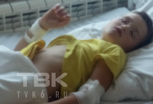 В Красноярском крае 8-летний мальчик получил ожоги, упав в яму с горячей золой