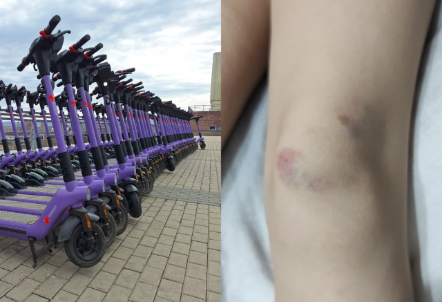 Двое подростков на электросамокате сбили 9-летнюю девочку в Красноярске Двое подростков на электросамокате сбили 9-летнюю девочку в Красноярске