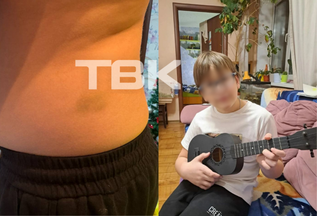 «Закидали его и собаку петардами, а потом отпинали»: в Красноярске подростки напали на 12-летнего школьника