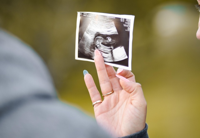 Красноярский край вошел в топ регионов по количеству абортов