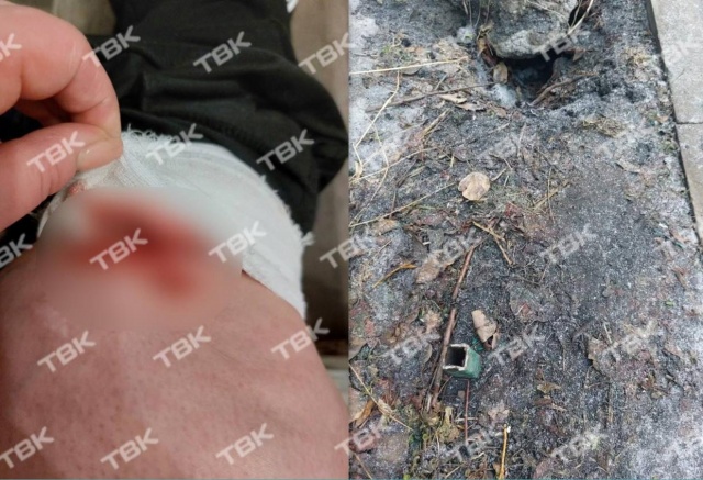 «Упала на штырь, разорвала колено»: красноярка во дворе повредила ногу куском старого забора	