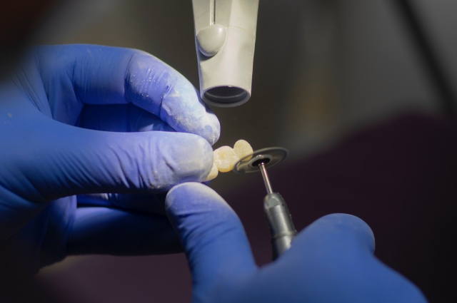 Назаровская стоматология выплатит пациентке 18-кратную стоимость лечения за выпавшую пломбу