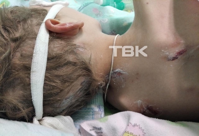 «Увидев ужас на спине ребенка, я спросила – чем вы его лечите?»: бабушка впавшего в кому мальчика рассказала, почему винит врачей